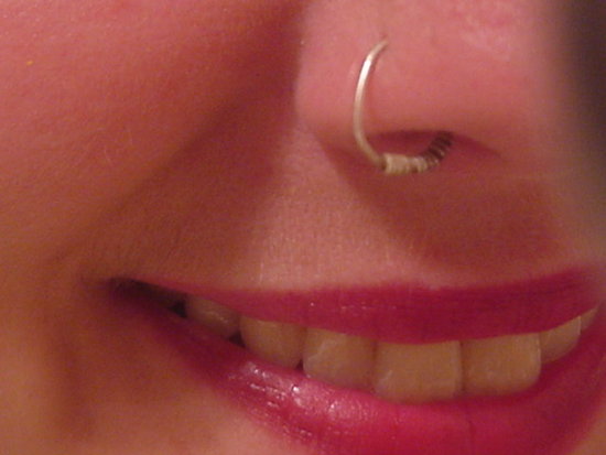 scarring from nose piercing. First Nose Piercing; First