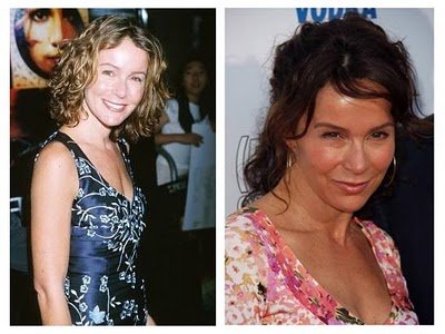 Plastic Surgery Harrisonburg on Jennifer Grey Plastic Surgery