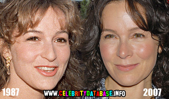 jennifer grey plastic surgery. jennifer grey plastic surgery