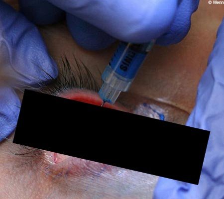 eye ball tattoo. Feb 28 2008 Eyeball Tattoos