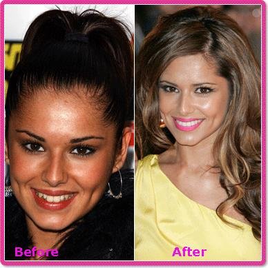 The Cheryl Cole Thread - Page 39 - RedCafe.net