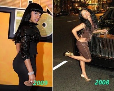 nicki minaj booty before surgery. Nicki Minaj Before And After