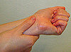 A-Wristed