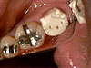 Kitty Tooth Bling