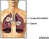 Your Children Breathe Secondhand Smoke