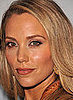 Elizabeth Berkley: Sectoral Heterochromia