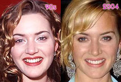 kate lots pic topless winslet. how good Kate Winslet#39;s